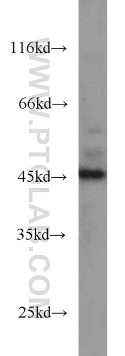 SMYD3 Rabbit anti-Human, Mouse, Rat, Polyclonal, Proteintech:Antibodies:Primary