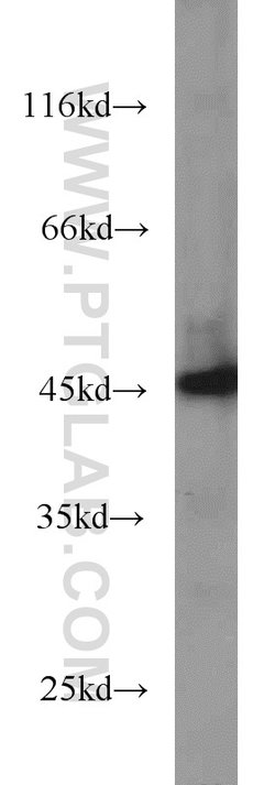 SMYD3 Rabbit anti-Human, Mouse, Rat, Polyclonal, Proteintech:Antibodies:Primary