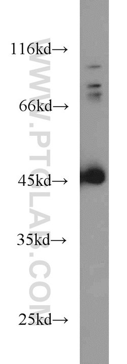 SMYD3 Rabbit anti-Human, Mouse, Rat, Polyclonal, Proteintech:Antibodies:Primary