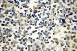 IKZF1 Rabbit anti-Human, Mouse, Rat, Polyclonal, Proteintech:Antibodies:Primary
