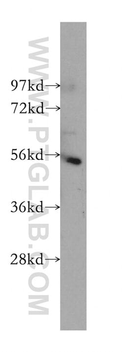 IKZF1 Rabbit anti-Human, Mouse, Rat, Polyclonal, Proteintech:Antibodies:Primary