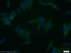 WBP2 Rabbit anti-Human, Mouse, Rat, Polyclonal, Proteintech:Antibodies:Primary