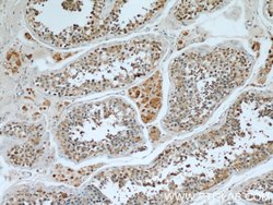 WBP2 Rabbit anti-Human, Mouse, Rat, Polyclonal, Proteintech:Antibodies:Primary