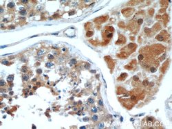WBP2 Rabbit anti-Human, Mouse, Rat, Polyclonal, Proteintech:Antibodies:Primary