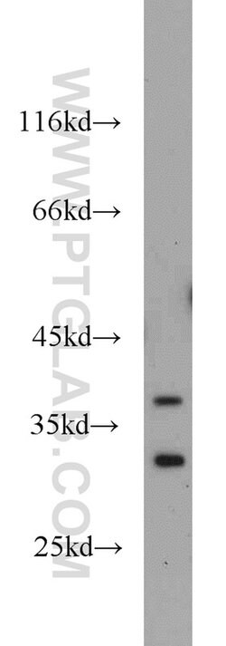 WBP2 Rabbit anti-Human, Mouse, Rat, Polyclonal, Proteintech:Antibodies:Primary