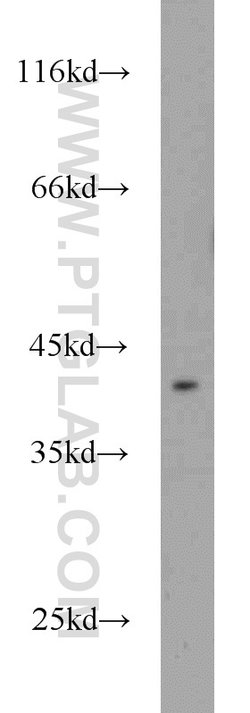 WBP2 Rabbit anti-Human, Mouse, Rat, Polyclonal, Proteintech:Antibodies:Primary