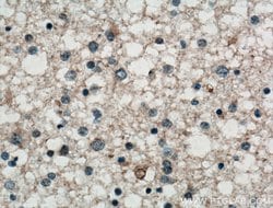 KCNIP3 Rabbit anti-Human, Mouse, Polyclonal, Proteintech 150 &mu;L; Unconjugated:Antibodies,