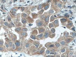 DVL2 Rabbit anti-Human, Mouse, Polyclonal, Proteintech:Antibodies:Primary