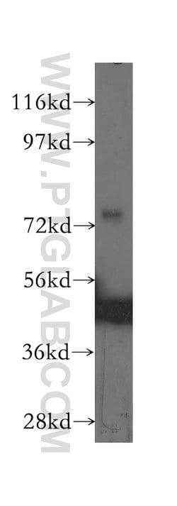 DVL2 Rabbit anti-Human, Mouse, Polyclonal, Proteintech:Antibodies:Primary