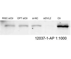 DVL2 Rabbit anti-Human, Mouse, Polyclonal, Proteintech:Antibodies:Primary