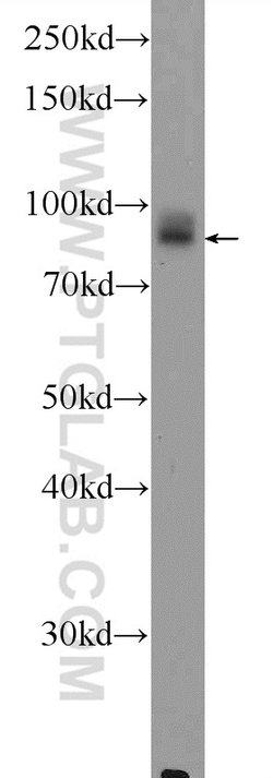 DVL2 Rabbit anti-Human, Mouse, Polyclonal, Proteintech:Antibodies:Primary