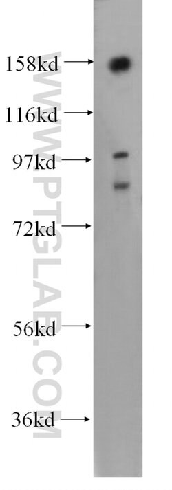 NOL8 Rabbit anti-Human, Mouse, Rat, Polyclonal, Proteintech:Antibodies:Primary