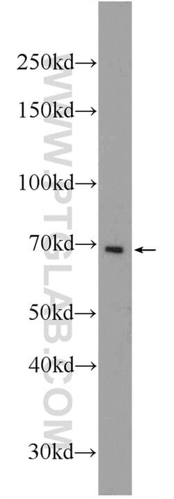 PCSK7 Rabbit anti-Human, Mouse, Rat, Polyclonal, Proteintech:Antibodies:Primary