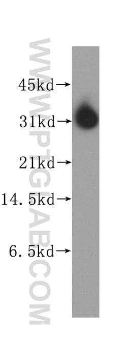 STOM Rabbit anti-Human, Polyclonal, Proteintech 150 &mu;L; Unconjugated:Antibodies,
