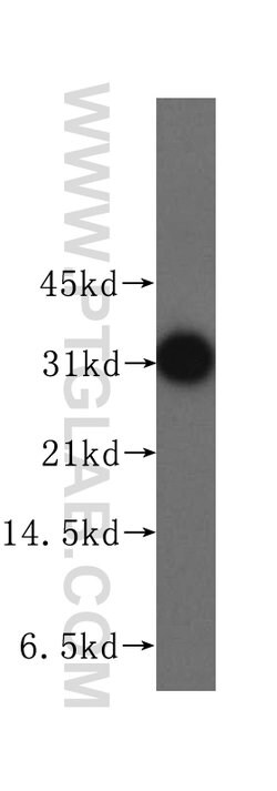 STOM Rabbit anti-Human, Polyclonal, Proteintech 150 &mu;L; Unconjugated:Antibodies,