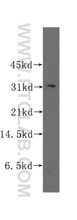 STOM Rabbit anti-Human, Polyclonal, Proteintech 150 &mu;L; Unconjugated:Antibodies,