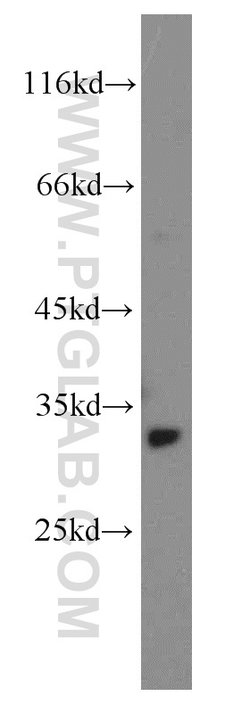 STOM Rabbit anti-Human, Polyclonal, Proteintech 150 &mu;L; Unconjugated:Antibodies,