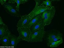 STOM Rabbit anti-Human, Polyclonal, Proteintech 150 &mu;L; Unconjugated:Antibodies,
