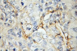 STOM Rabbit anti-Human, Polyclonal, Proteintech 150 &mu;L; Unconjugated:Antibodies,