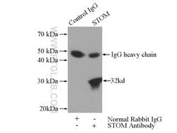 STOM Rabbit anti-Human, Polyclonal, Proteintech 150 &mu;L; Unconjugated:Antibodies,