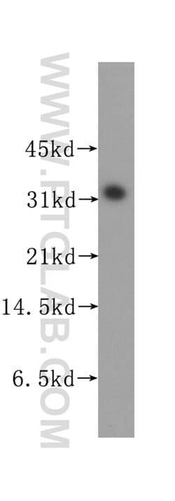 STOM Rabbit anti-Human, Polyclonal, Proteintech 150 &mu;L; Unconjugated:Antibodies,