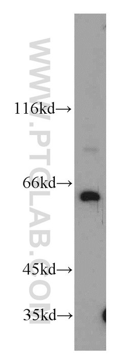 PSMD3 Rabbit anti-Human, Mouse, Rat, Polyclonal, Proteintech:Antibodies:Primary