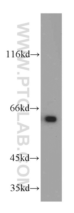 PSMD3 Rabbit anti-Human, Mouse, Rat, Polyclonal, Proteintech:Antibodies:Primary