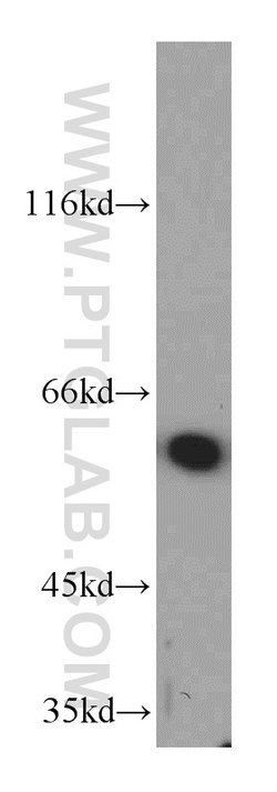 PSMD3 Rabbit anti-Human, Mouse, Rat, Polyclonal, Proteintech:Antibodies:Primary