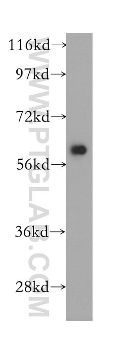 PSMD3 Rabbit anti-Human, Mouse, Rat, Polyclonal, Proteintech:Antibodies:Primary