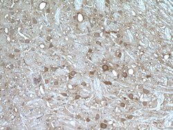 PYGB Rabbit anti-Human, Mouse, Rat, Polyclonal, Proteintech:Antibodies:Primary