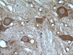 PYGB Rabbit anti-Human, Mouse, Rat, Polyclonal, Proteintech:Antibodies:Primary