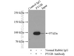 PYGB Rabbit anti-Human, Mouse, Rat, Polyclonal, Proteintech:Antibodies:Primary