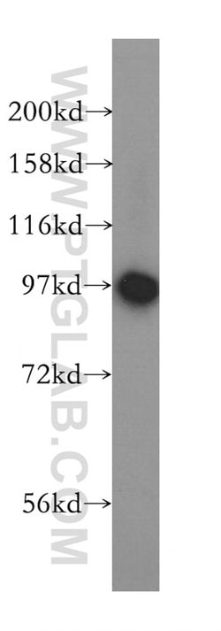 PYGB Rabbit anti-Human, Mouse, Rat, Polyclonal, Proteintech:Antibodies:Primary