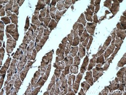 PYGB Rabbit anti-Human, Mouse, Rat, Polyclonal, Proteintech:Antibodies:Primary