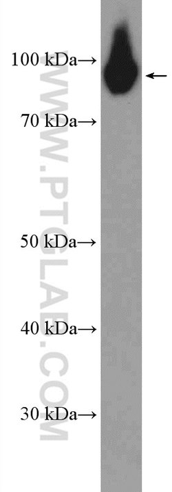 PYGB Rabbit anti-Human, Mouse, Rat, Polyclonal, Proteintech:Antibodies:Primary