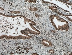 USP48 Rabbit anti-Human, Mouse, Rat, Polyclonal, Proteintech:Antibodies:Primary