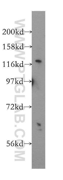 USP48 Rabbit anti-Human, Mouse, Rat, Polyclonal, Proteintech:Antibodies:Primary