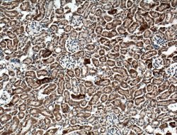 SLC25A10 Rabbit anti-Human, Mouse, Rat, Polyclonal, Proteintech:Antibodies:Primary