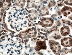 SLC25A10 Rabbit anti-Human, Mouse, Rat, Polyclonal, Proteintech:Antibodies:Primary