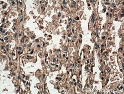 SLC25A10 Rabbit anti-Human, Mouse, Rat, Polyclonal, Proteintech:Antibodies:Primary