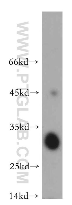 SLC25A10 Rabbit anti-Human, Mouse, Rat, Polyclonal, Proteintech:Antibodies:Primary