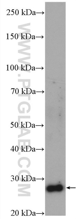 SLC25A10 Rabbit anti-Human, Mouse, Rat, Polyclonal, Proteintech:Antibodies:Primary
