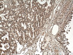 SLC25A10 Rabbit anti-Human, Mouse, Rat, Polyclonal, Proteintech:Antibodies:Primary