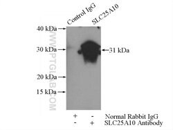 SLC25A10 Rabbit anti-Human, Mouse, Rat, Polyclonal, Proteintech:Antibodies:Primary