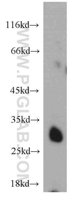 SLC25A10 Rabbit anti-Human, Mouse, Rat, Polyclonal, Proteintech:Antibodies:Primary