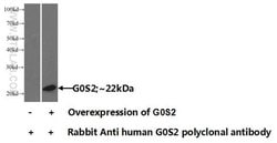 G0S2 Rabbit anti-Human, Mouse, Polyclonal, Proteintech 150 &mu;L; Unconjugated:Antibodies,