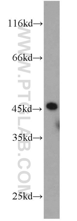 UBA5 Rabbit anti-Human, Mouse, Polyclonal, Proteintech 150 &mu;L; Unconjugated:Antibodies,