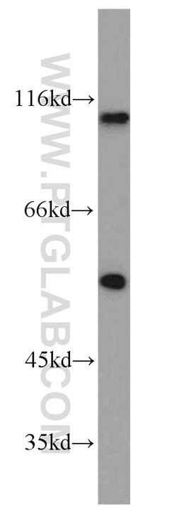PBXIP1 Rabbit anti-Human, Polyclonal, Proteintech 150 &mu;L; Unconjugated:Antibodies,