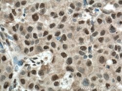 BCOR Rabbit anti-Human, Mouse, Rat, Polyclonal, Proteintech:Antibodies:Primary