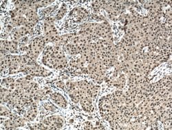BCOR Rabbit anti-Human, Mouse, Rat, Polyclonal, Proteintech:Antibodies:Primary